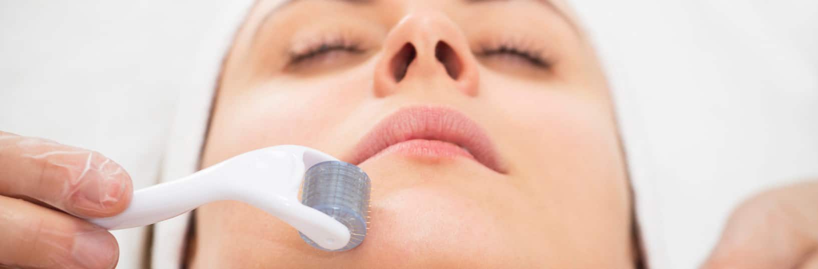 Microneedling facial treatment