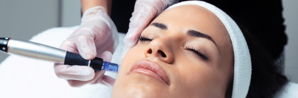 Microneedling Beauty Treatment