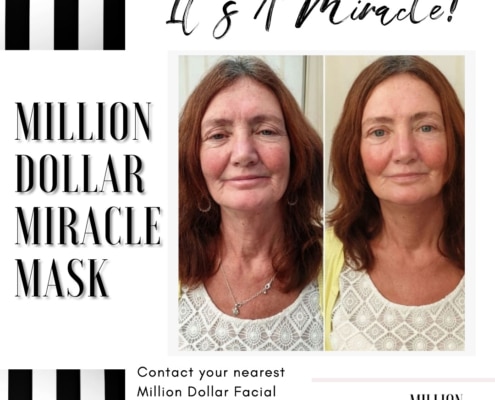 Million Dollar facial miracle mask