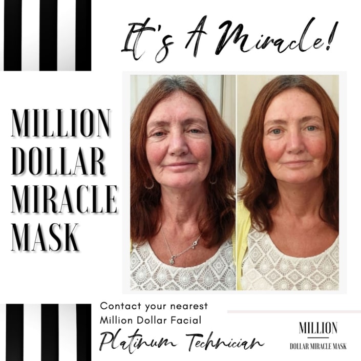 Million Dollar facial miracle mask