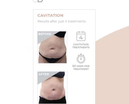 Results from Cavitation after 60 mins