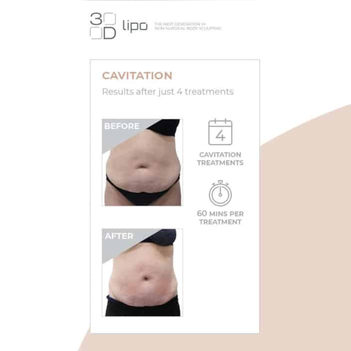 Results from Cavitation after 60 mins