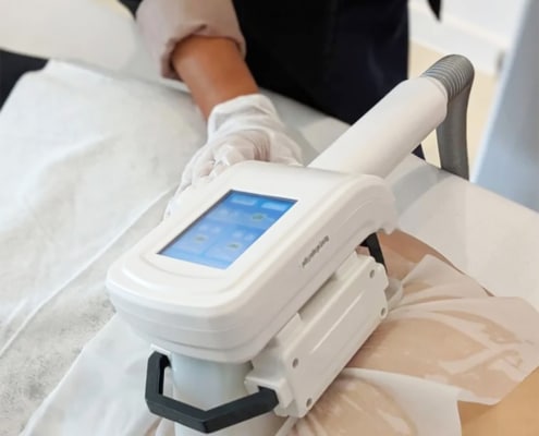 Cryolipolysis machine in action