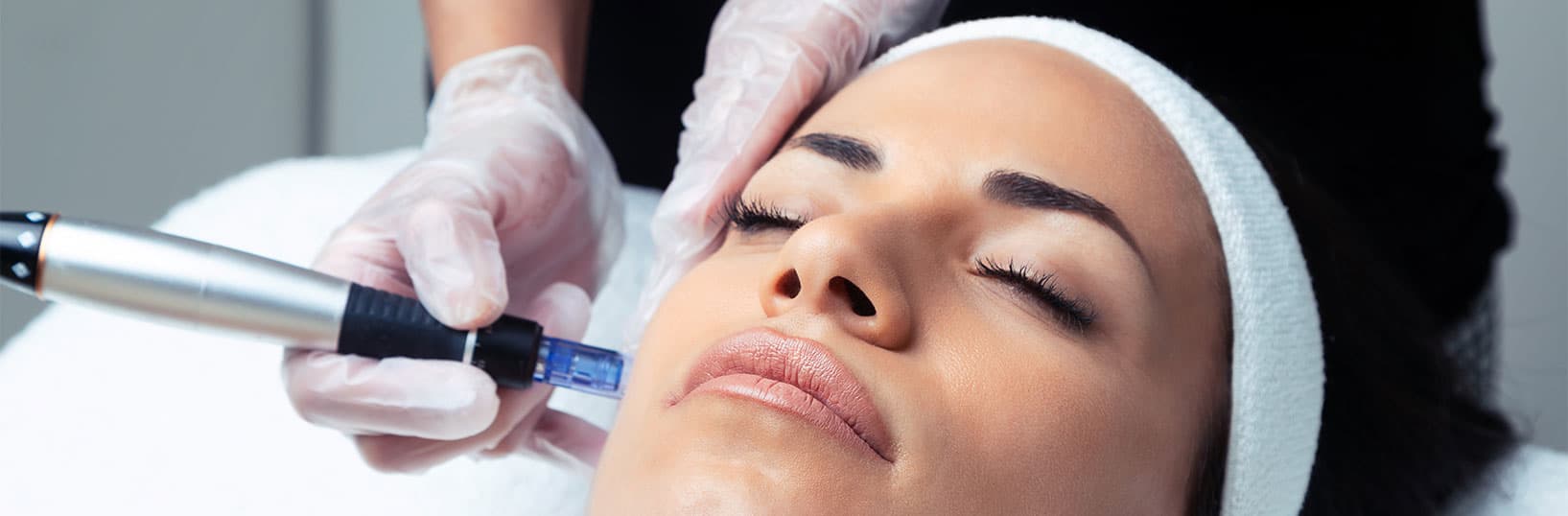 Three-stage microneedling skin boost facial treatment at Pure Synergie beauty salon in Greenwich